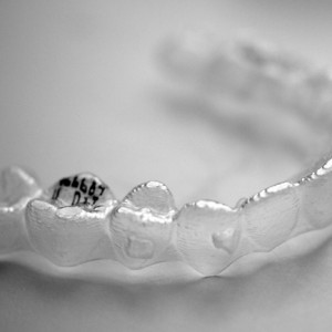 clear-orthodontic-treatment-options