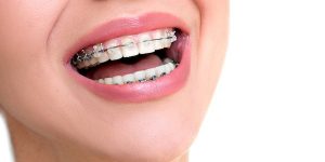 top-nyc-orthodontist