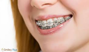 best-orthodontist-for-traditional-braces-01