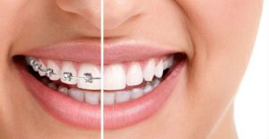 choosing-best-orthodontist-nyc-01