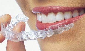 dentist-specialist-for-clear-aligners-04