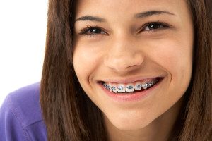 best-orthodontist-for-braces-nyc-03
