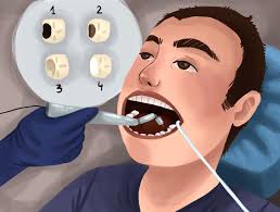top-nyc-dentist-for-cavities-root-canal-02