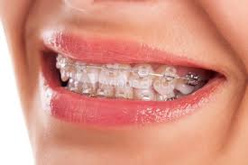top-orthodontist-nyc-01