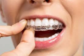 manhattan-orthodontist-clear-aligner-adult-braces-02