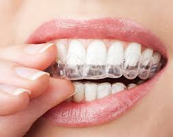 straightenadult-teeth-invisalign-orthodontist-nyc-03