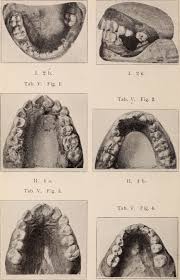 history-of-orthodontics-01