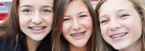 how-long-wear-braces-faq-top-ortho-nyc-01