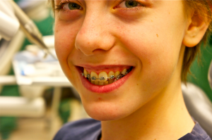 best-braces-for-children-nyc-orthodontist-01