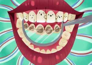 invisible-braces-nyc-orthodontist-02