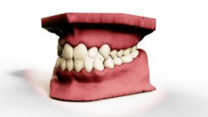 History of Orthodontics through time