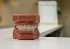 What Is Orthodontia?