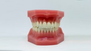 NYC Orthodontist Types of Braces 2023