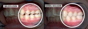 nyc-top-orthodontist-malocclusion-teeth-specialists-01