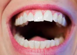 orthodontist-straighten-crooked-teeth-01