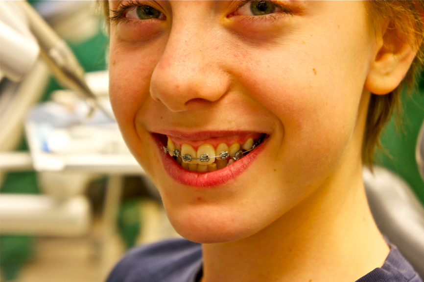 Braces for Children - Best Orthodontist NYC