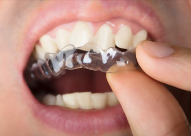 Invisible Braces - Best Orthodontist NYC