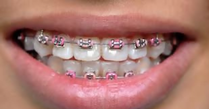 trends in orthodontics 2019 2020