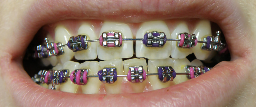 Orthodontist Cumming