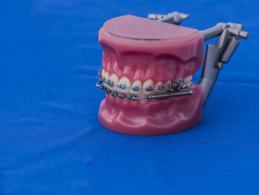 Average Cost of Metal Braces | Orthodontist NYC 