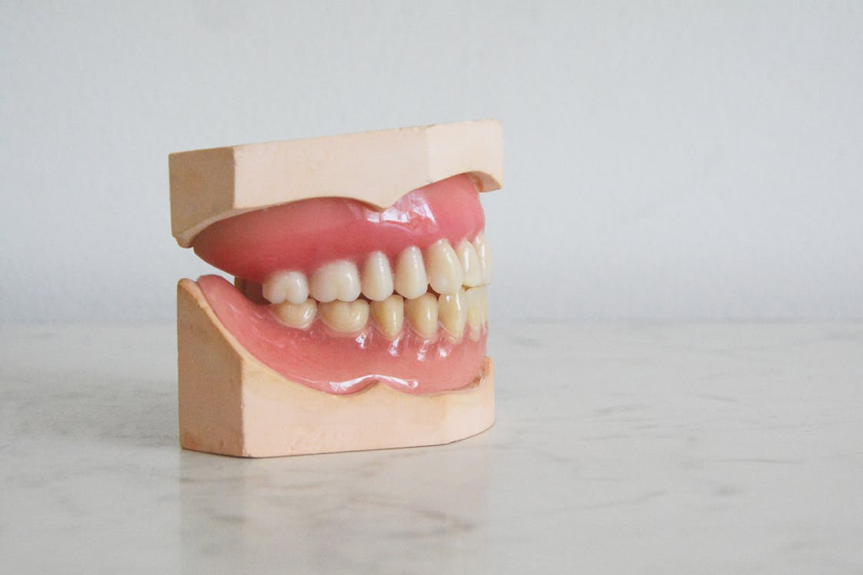 What are the different types of dentures?