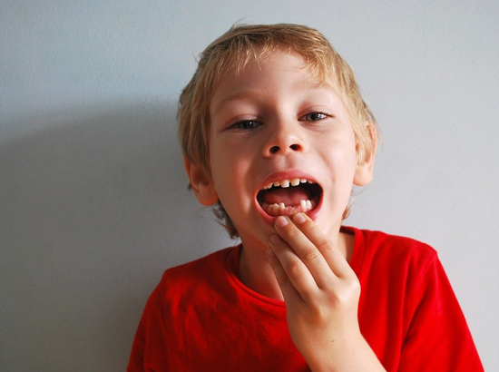 Braces for Baby Teeth